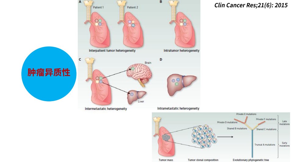 單細胞藥敏在腫瘤臨床治療中的應用